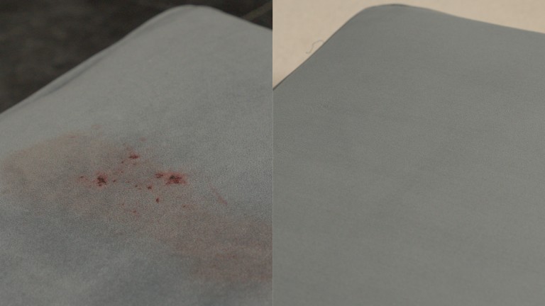 Before After Stain Removal